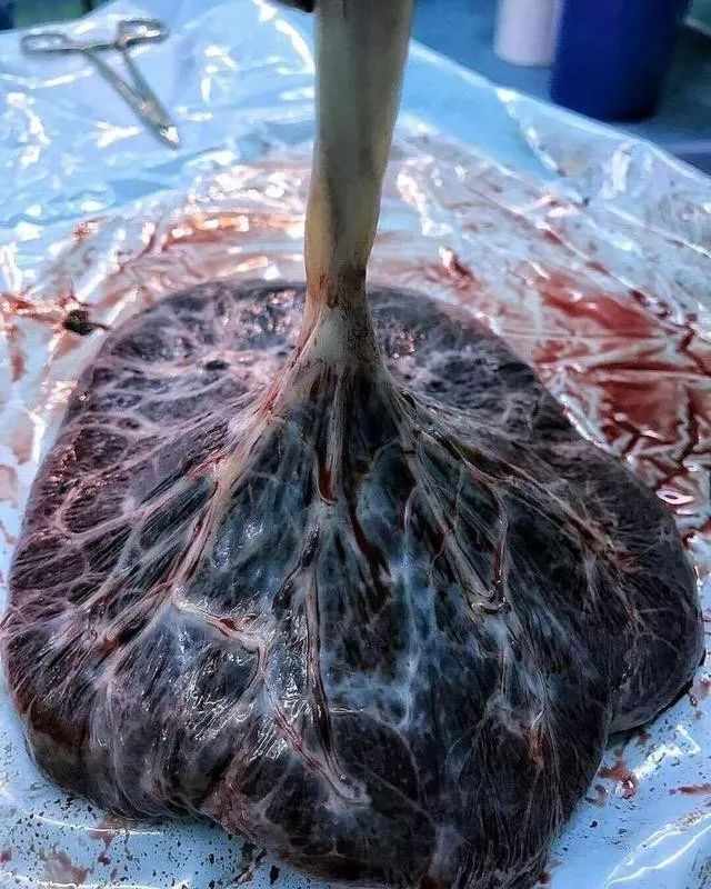 砧骨和镫骨为什么最容易缺失_砧骨镫骨怎么读拼音_砧骨