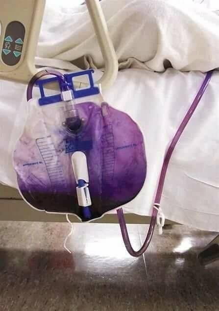 砧骨和镫骨为什么最容易缺失_砧骨镫骨怎么读拼音_砧骨